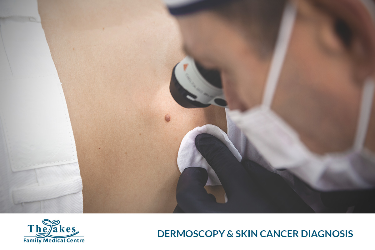 Dermoscopy a precise tool for skin cancer diagnosis